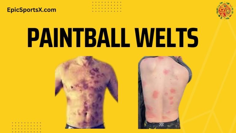 Paintball Welts